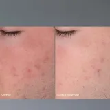 Пилинг для лица Dermalogica Daily Microfoliant, 13 г - Travel Size / 75 г — фото 6