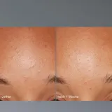 Пилинг для лица Dermalogica Daily Microfoliant, 13 г - Travel Size / 75 г — фото 8