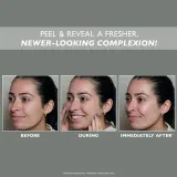 Пилинг для лица Peter Thomas Roth FirmX Peeling Gel, 100 мл — фото 5