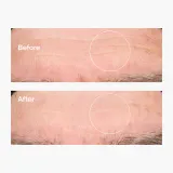 The Ordinary Hyaluronic Acid 2% + B5 сыворотка с гиалуроновой кислотой, 60 мл — фото 6
