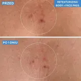 Murad Retexturizing Body Pads Диски отшелушивающие для тела с салициловой кислотой 2%, 1 шт — фото 5