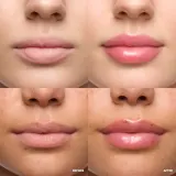 Блеск для губ WONDERSKIN LIP RELAPSE PLUMPING GLOSS, 36 г — фото 3