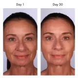 Сыворотка против старения U Beauty Resurfacing Compound, 30 мл / 50 мл — фото 6