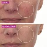 Увлажняющая сыворотка Murad, 30 мл — фото 6