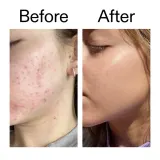 Сыворотка для лица: Glow Serum The Inkey List, 30 мл — фото 8