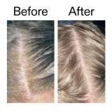 Уход за кожей головы The Inkey List Salicylic Scalp Treatment, 150 мл — фото 6