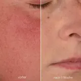 Крем для лица Dermalogica Stabilizing Repair Cream, 50 мл — фото 4