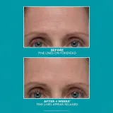 Peter Thomas Roth Peptide Skinjection Amplified Wrinkle-Fix Сыворотка для лица с пептидами, против морщин, 30 мл — фото 6