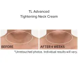 StriVectin Gamechanger Набор для лица и шеи: крем SD Advanced 47 мл и крем для шеи TL Neck Cream 30 мл, 1 шт — фото 5