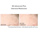 StriVectin Gamechanger Набор для лица и шеи: крем SD Advanced 47 мл и крем для шеи TL Neck Cream 30 мл, 1 шт — фото 6