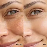 Мезо-сыворотка для лица DermoPrecision, с микроиглами и комплексом CICA, восстанавливающая — фото 5