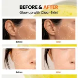 Сыворотка для лица KSECRET Seoul 1988 Glow Serum Niacinamide 15% + Yuja осветляющая, для ровного тона, 30 мл — фото 4