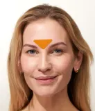 Патчи для лица от морщин Apricot It's a Skin-vestment с ниацинамидом, для кожи с пигментными пятнами, 24 шт. — фото 2