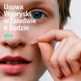 Патчи от высыпаний Cetaphil Blemish Prone, для кожи с несовершенствами, 24 шт. — фото 2
