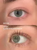 Сыворотка для ресниц Xlash Eyelash Serum, для длины и густоты, 5 мл — фото 5