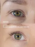 Сыворотка для ресниц Xlash Sensitive Eyelash Serum, для чувствительных глаз, 3 мл — фото 5