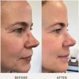 Сыворотка для лица Evolve Organic Beauty Age Defying Lifting Serum, подтягивающая, разглаживающая, 30 мл — фото 5
