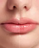 Плампер для губ VT Cosmetics Reedle Shot Lip Plumper Beginner с микроиглами, с эффектом объёма, 4,3 г — фото 4