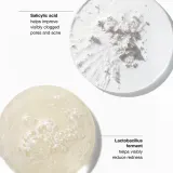Clinique Anti-Blemish Solutions Liquid Makeup - Тональная основа для жирной кожи с проблемами акне, 30 мл, оттенок WN 118 Amber — фото 5