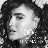 Vichy Dercos Anti-Dandruff - Шампунь против перхоти для сухих волос., 200 ml — фото 2
