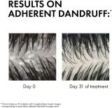 Vichy Dercos Anti-Dandruff - Шампунь против перхоти для сухих волос., 200 ml — фото 5