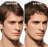 Kerastase Genesis Homme Serum Anti-chute Fortifiant - Укрепляющая сыворотка для слабых волос с склонностью к выпадению для мужчин, 90 ml — фото 5
