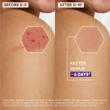 A-Derma Epitheliale A.H. Ultra - Обновляющий крем для раздраженной кожи, 40 ml — фото 5