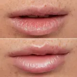 WONDERSKIN Lip Rehab Therapy Oil - Блеск для губ с увлажняющим действием, 3.57 мл, оттенок Clear — фото 4