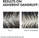 Vichy Dercos Anti-Dandruff - Шампунь против перхоти для нормальных и склонных к жирности волос — фото 3