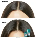 L’Oreal Professionnel Serie Expert Scalp Advanced - Шампунь для чувствительной и раздраженной кожи головы — фото 4