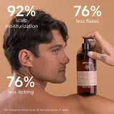 Apivita Dandruff Dry Dandruff Shampoo - Шампунь против перхоти — фото 4