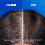 Head & Shoulders Deep Hydration Coconut - Шампунь против перхоти — фото 7