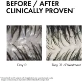 Vichy Dercos Serum 10 - Куративная сыворотка против перхоти, 90 мл — фото 6