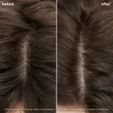 Biolage ScalpSync - концентрат для кожи головы, 200 мл — фото 2