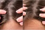 FOREO FAQ Scalp Recovery & Thick Hair Probiotic Serum - Сыворотка для волос и кожи головы с пробиотиками, 60 мл — фото 6