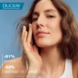 Ducray Kelual DS Anti-Scales Cleansing Gel - Гель для очищения раздраженной и шелушащейся кожи, 200 мл — фото 4
