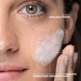 La Roche-Posay Effaclar - Очищающий гель-скраб для жирной и проблемной кожи — фото 3