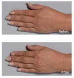 Perricone MD Cold Plasma Plus+ Hand Therapy - Крем для ухода за руками, 59 мл — фото 6
