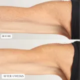 Perricone MD High Potency Intensive Body Therapy - Интенсивное питательное молочко для тела, 177 мл — фото 6