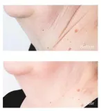 Perricone MD Cold Plasma Plus+ Sub-D/Neck - Укрепляющий крем для шеи и декольте, 59 мл — фото 6
