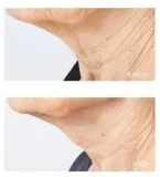 Perricone MD Cold Plasma Plus+ Sub-D/Neck - Укрепляющий крем для шеи и декольте, 59 мл — фото 7