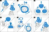 Philips 5000/7000 Series SH71/50 - Сменные насадки для бритья SH71/50, 1 шт — фото 4