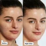 Dr. Jart+ Cicapair Tiger Grass Color Correcting Treatment - Крем интенсивно уменьшающий покраснения — фото 3