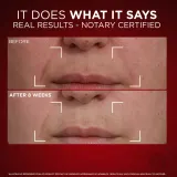 L’Oreal Paris Revitalift Laser X3 - Набор против старения кожи, 2 мл — фото 3