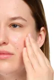 The Ordinary Salicylic Acid 2% Anhydrous Solution - Сыворотка для лица выравнивает тон кожи, 30 мл — фото 5