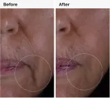 The Ordinary Growth Factors Solution - Сыворотка для лица, разглаживающая морщины, 30 мл — фото 4