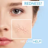 Dermedic Redness Calm - Крем против покраснений и расширенных сосудов, 40 мл — фото 5