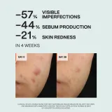 Saffee ClearDerm Day & Night Care Set - Набор для проблемной кожи — фото 3