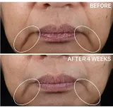Лифтинг-крем для лица StriVectin Contour Restore Tightening Sculpting, укрепляет контуры, увлажняет, 50 мл — фото 4