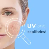 Dermedic Redness Calm - Крем против покраснений и расширенных сосудов SPF 20, 40 мл — фото 5